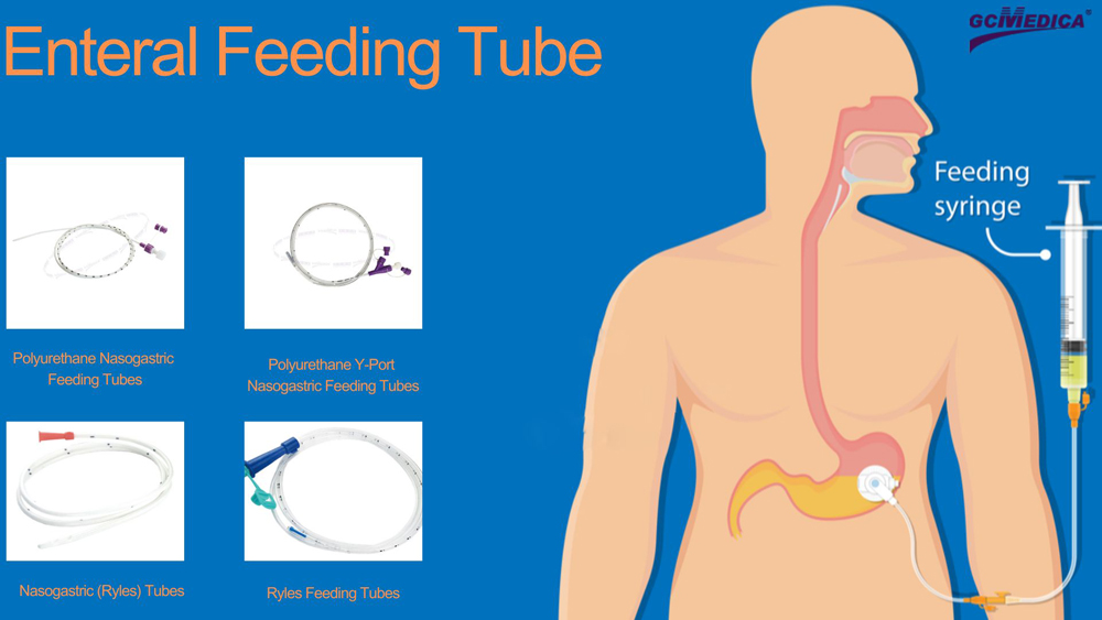 Enteral_Feeding_Tube_sale.jpg